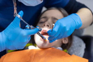 Understanding Endodontic Treatment in Torrance: A Complete Guide